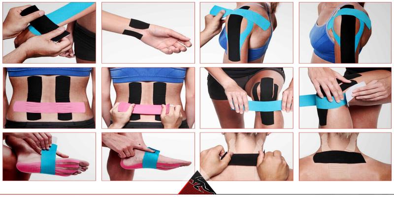 Kinesiology Taping Technique